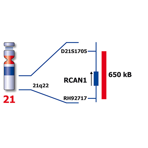 IVD RB1/RCAN1, SE X/SE Y/ SE 18 製品画像 Back View S